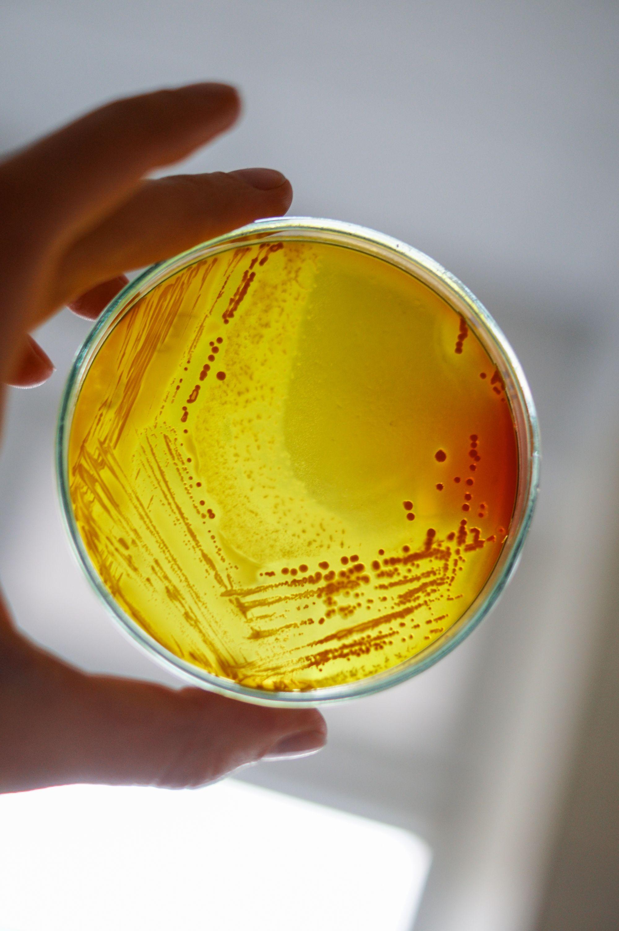 Hand holding a yellow and orange-stained petri dish of bacteria